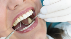 Desde $17.50: Servicios Dentales